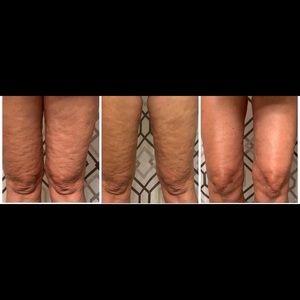 Cellulite Cream= liquid gold!!!